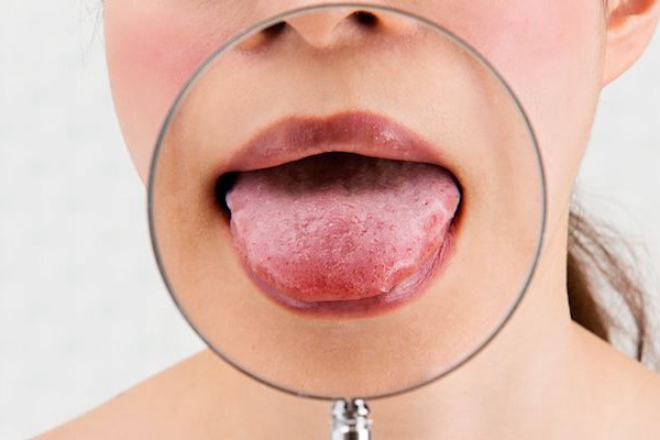Tongue Diagnosis examination